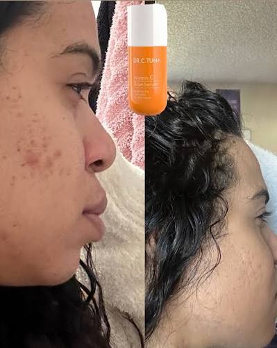 Glow up - Wrinkle Reducer- Look Younger- Smooth Complexion Skin Care Set - Farmasi