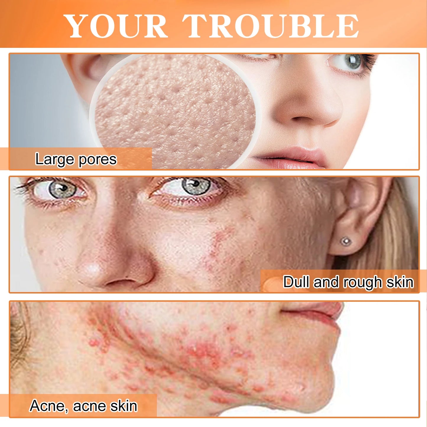 Natural Handmade Removing Acne Tumeric Soap &  Skin Brightening Serum