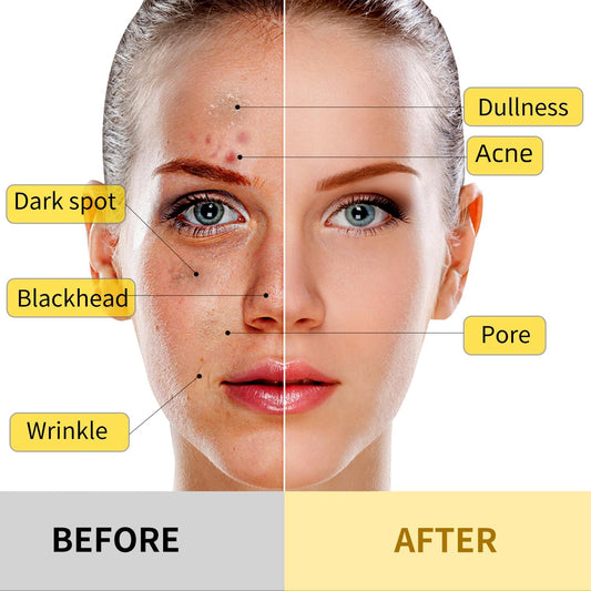 Tumeric Vitamin C Clay Mask for Glowing Smooth Skin - 4 Piece Skin Set