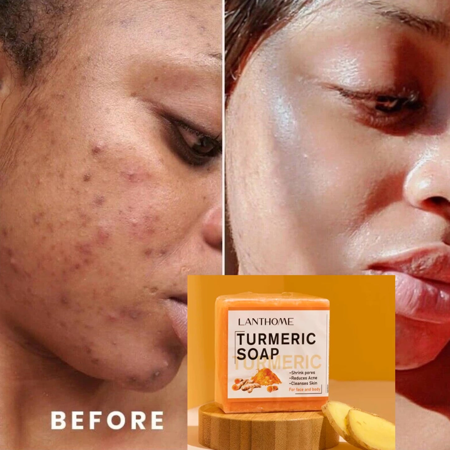 Tumeric Soap Skin Brightening Ezecma Blemishes Psoriasis Acne Dark Spots Remover Clear Scrub