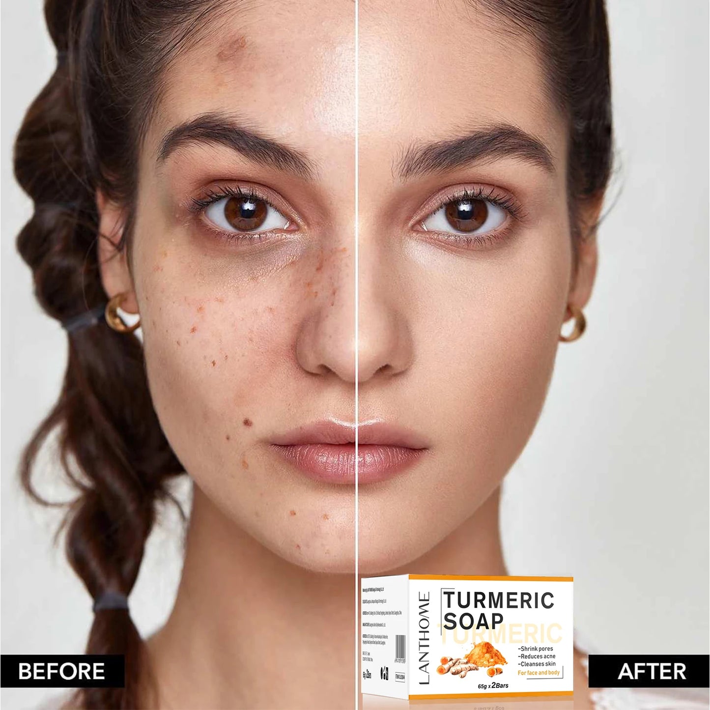 Natural Handmade Removing Acne Tumeric Soap &  Skin Brightening Serum