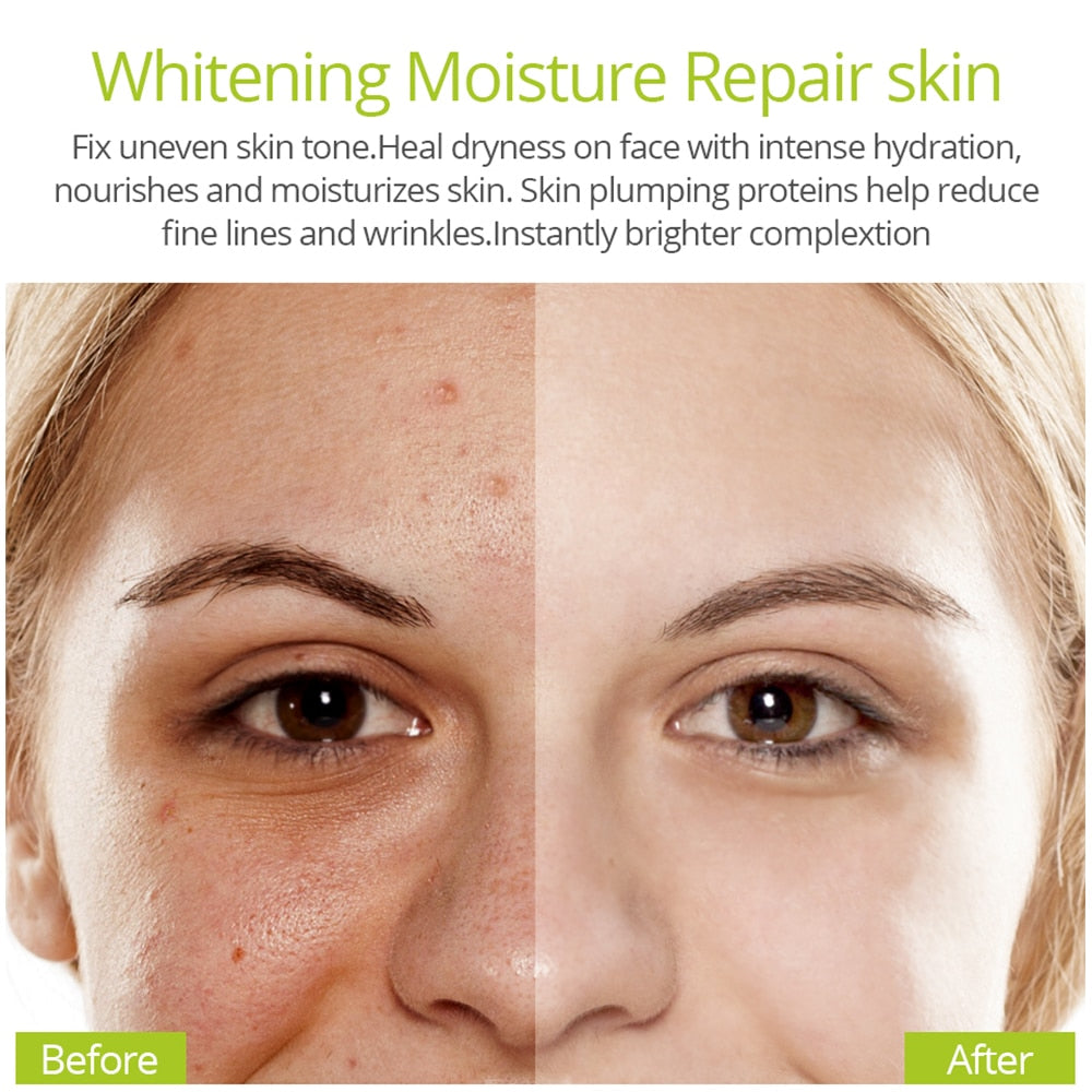 VIBRANT GLAMOUR Vitamin C Whitening Face Serum Hyaluronic Acid Cream Remover Acne Treatment Fade Dark Spots Anti-Aging Skin Care