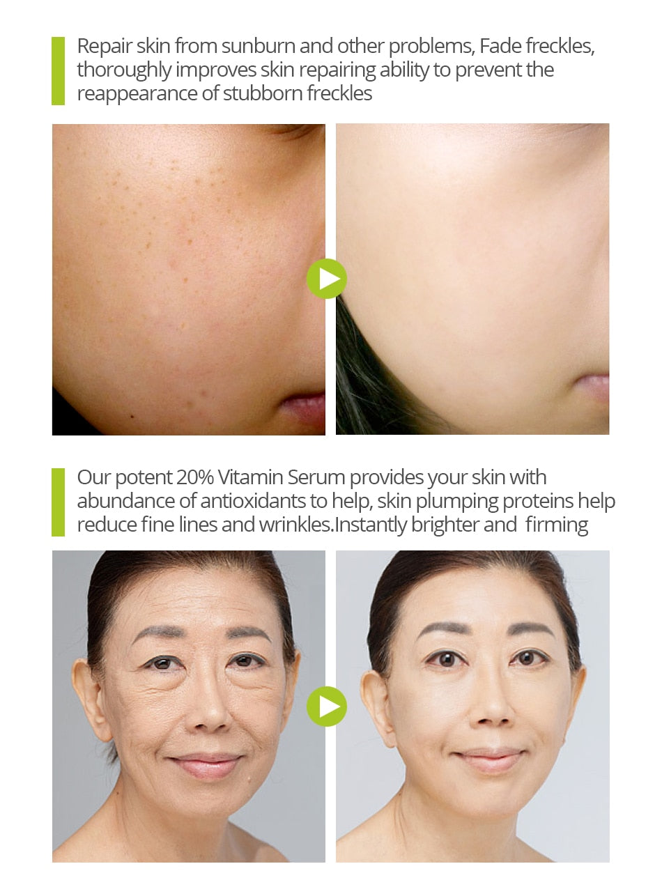 VIBRANT GLAMOUR Vitamin C Whitening Face Serum Hyaluronic Acid Cream Remover Acne Treatment Fade Dark Spots Anti-Aging Skin Care