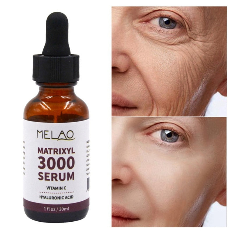 3000 Serum Vitamin C Hyaluronic Acid Reduce Sun Spots And Wrinkles Serum