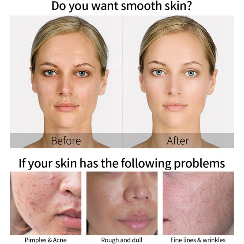 3000 Serum Vitamin C Hyaluronic Acid Reduce Sun Spots And Wrinkles Serum
