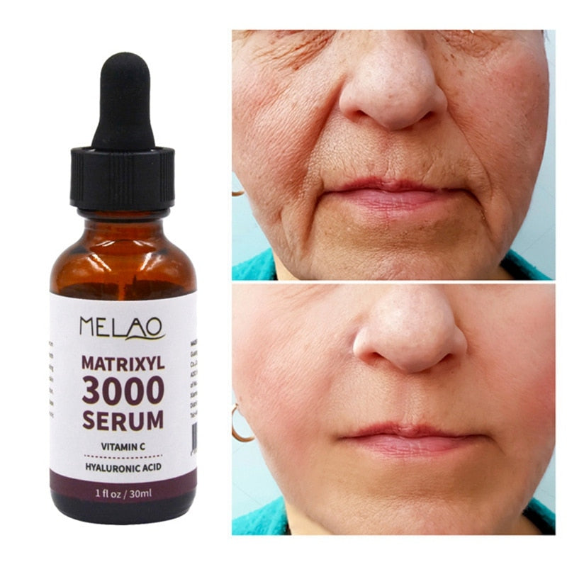 3000 Serum Vitamin C Hyaluronic Acid Reduce Sun Spots And Wrinkles Serum