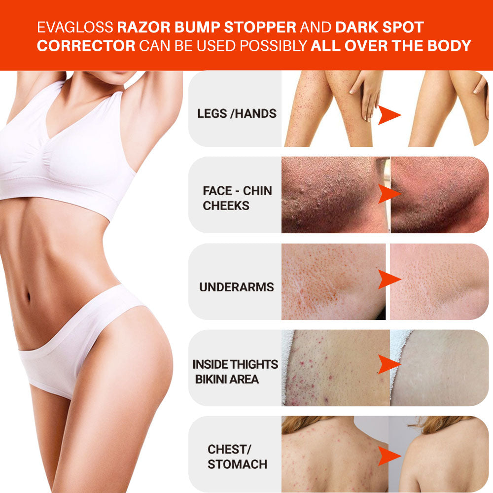 Razor bumps and Ingrown Hair treatment  After Shave vanish pfb for Ingrown Hairs and Razor Burns roll on for black Men and Women