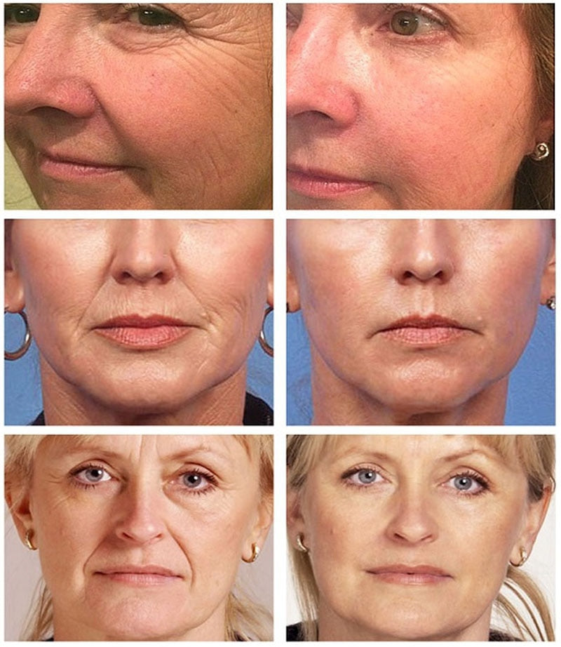 Vitamin C Brightening Remove Dark Spots Facial Repair Fade Serum