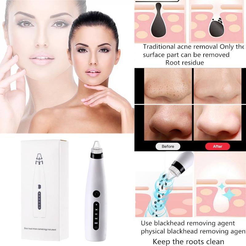 Facial Blackhead Remover