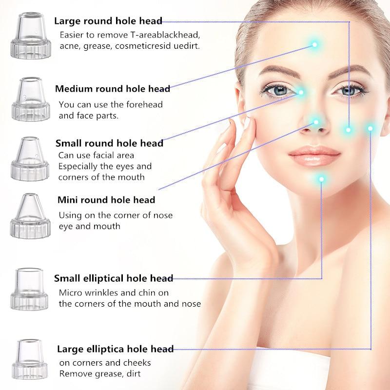 Facial Blackhead Remover
