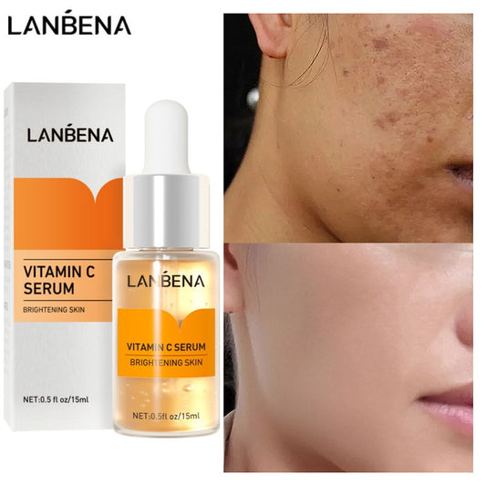 Vitamin C Whitening Face Serum Lighten Spots Brightening Facial Skin Essence Fade Dark Spots Remove Freckle Speckle Care
