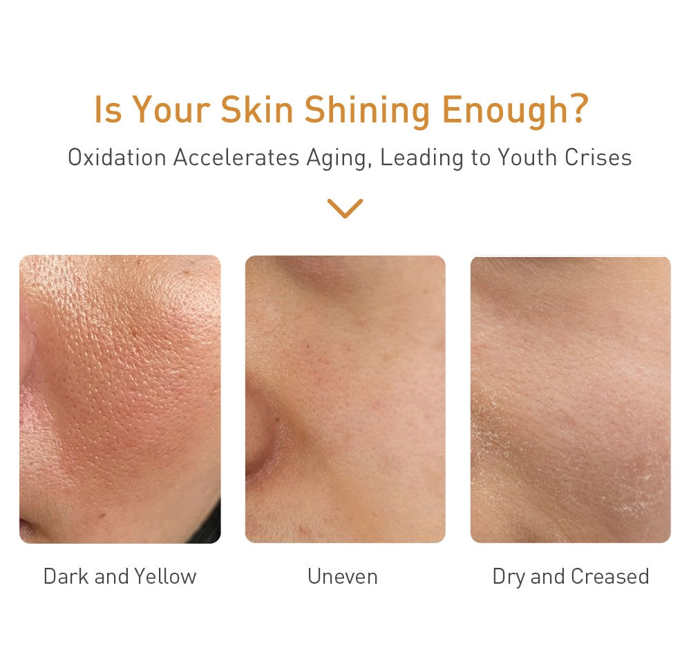 Vitamin C Whitening Face Serum Lighten Spots Brightening Facial Skin Essence Fade Dark Spots Remove Freckle Speckle Care