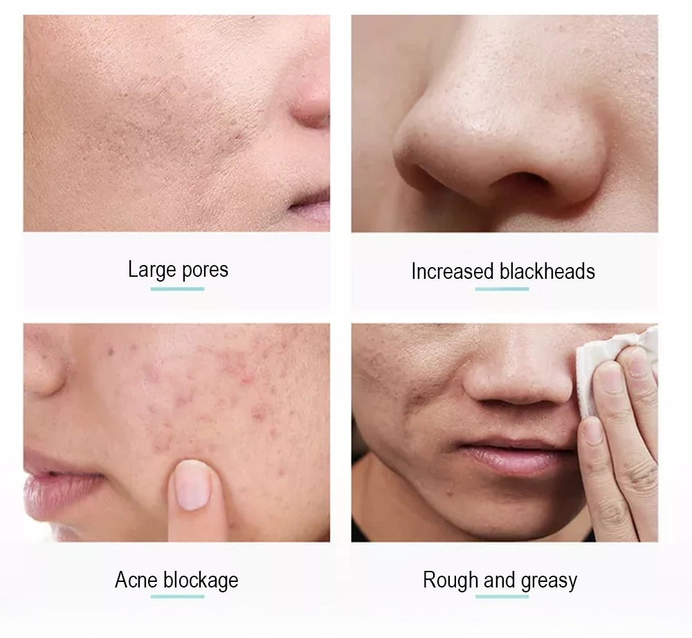 Exfoliating Face Scrub Peeling Gel Moisturizing Whitening Lemon Vitamin C Remove Acne Detoxifies And Cleanses All Skin