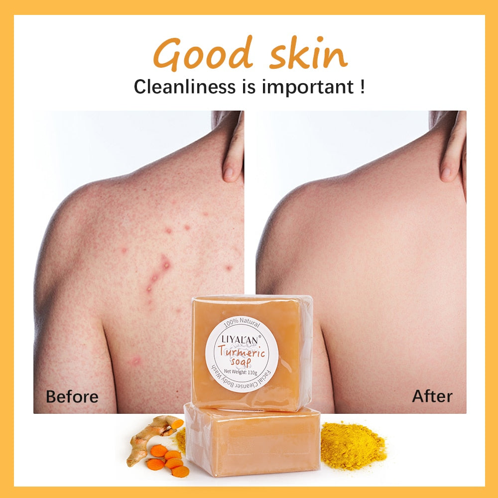 Turmeric Soap Face Cleansing Anti Acne Skin Brighten Remove Pimples Dark Spot Lightening Handmade Ginger Essential Oil Body Bath