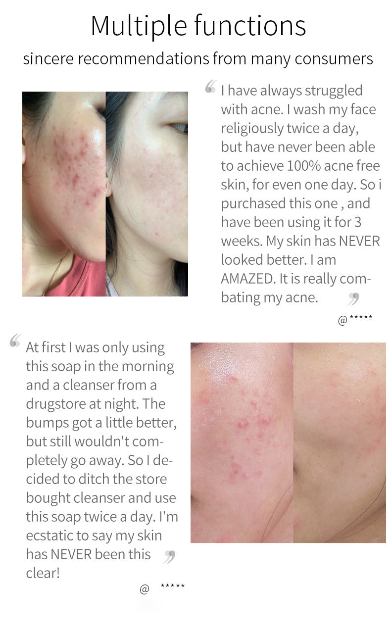 Tumeric Soap Skin Brightening Ezecma Blemishes Psoriasis Acne Dark Spots Remover Clear Scrub